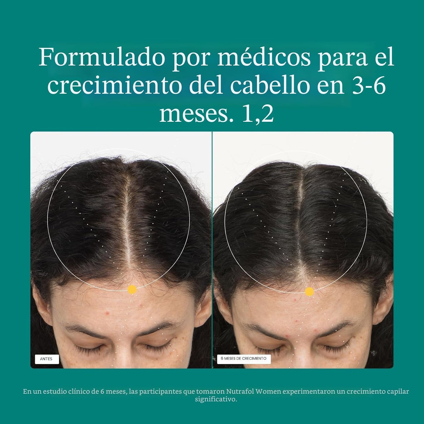 Nutrafol - Suplementos de crecimiento del cabello